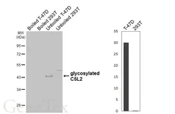 Anti-C5L2 antibody [HL4182] used in Western Blot (WB). GTX642996
