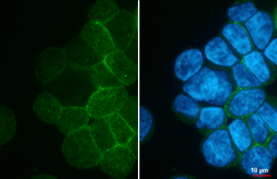 Anti-CD23 antibody [GT176] used in Immunocytochemistry/ Immunofluorescence (ICC/IF). GTX643014