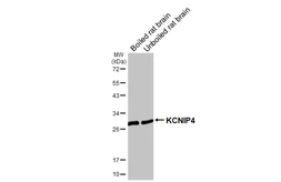 Anti-KCNIP4 antibody [GT178] used in Western Blot (WB). GTX643016