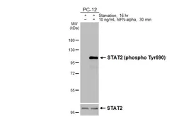 Anti-STAT2 (phospho Tyr690) antibody [HL4208] used in Western Blot (WB). GTX643031