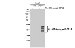 Anti-CCRL2 antibody [HL4222] used in Western Blot (WB). GTX643044