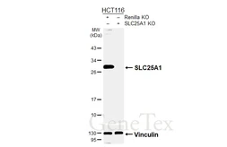 Anti-SLC25A1 antibody [HL4228] used in Western Blot (WB). GTX643061
