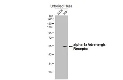 Anti-alpha 1a Adrenergic Receptor antibody [HL4266] used in Western Blot (WB). GTX643502