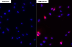 Anti-Tick-borne encephalitis virus (TBEV) Capsid antibody [HL4292] used in Immunocytochemistry/ Immunofluorescence (ICC/IF). GTX643532