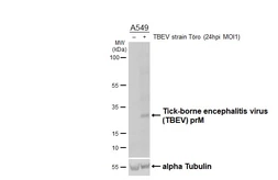 Anti-Tick-borne encephalitis virus (TBEV) prM protein antibody [HL4295] used in Western Blot (WB). GTX643535