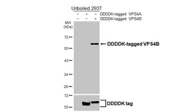 Anti-VPS4B antibody [HL4340] used in Western Blot (WB). GTX643590
