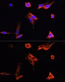 Anti-PINK1 antibody used in Immunocytochemistry/ Immunofluorescence (ICC/IF). GTX64362