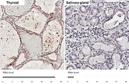 Anti-ADAM10 antibody [HL4378] used in IHC (Paraffin sections) (IHC-P). GTX643635