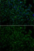 Anti-Angiogenin antibody used in Immunocytochemistry/ Immunofluorescence (ICC/IF). GTX64392