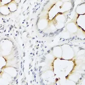 Anti-MDC antibody used in IHC (Paraffin sections) (IHC-P). GTX64394