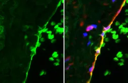 Anti-ICAM1 / CD54 antibody [HL4447] used in IHC (Paraffin sections) (IHC-P). GTX644012