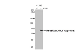 Anti-Influenza A virus PA protein antibody [HL4504] used in Western Blot (WB). GTX644074