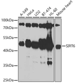 Anti-SIRT6 antibody used in Western Blot (WB). GTX64410