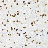 Anti-KAP1 antibody used in Immunocytochemistry/ Immunofluorescence (ICC/IF). GTX64422