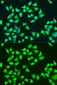 Anti-ATP6 antibody used in Immunocytochemistry/ Immunofluorescence (ICC/IF). GTX64448