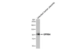Anti-GPR84 antibody [HL4667] used in Western Blot (WB). GTX644540