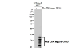 Anti-GPR31 antibody [HL4702] used in Western Blot (WB). GTX644703