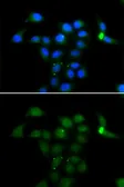 Anti-Tyrosine Aminotransferase antibody used in Immunocytochemistry/ Immunofluorescence (ICC/IF). GTX64477
