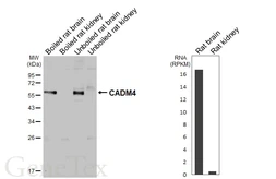 Anti-CADM4 antibody [GT272] used in Western Blot (WB). GTX644789