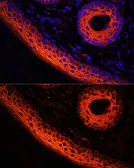 Anti-Desmoglein 1 antibody used in IHC (Paraffin sections) (IHC-P). GTX64482