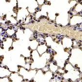 Anti-NSD2 antibody used in IHC (Paraffin sections) (IHC-P). GTX64491