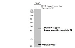 Anti-Lassa virus Glycoprotein G2 antibody [HL4881] used in Western Blot (WB). GTX644946