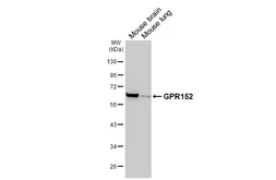 Anti-GPR152 antibody [HL4936] used in Western Blot (WB). GTX645009