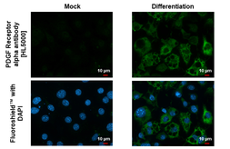 Anti-PDGF Receptor alpha antibody [HL5000] used in Immunocytochemistry/ Immunofluorescence (ICC/IF). GTX645093