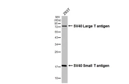 Anti-SV40 T-antigen antibody [HL5013] used in Western Blot (WB). GTX645106