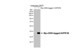 Anti-AVPR1B antibody [HL5060] used in Western Blot (WB). GTX645230