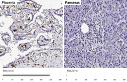 Anti-Factor XIIIa antibody [HL5069] used in IHC (Paraffin sections) (IHC-P). GTX645259