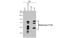 Anti-Enterovirus 71 3D antibody [HL5128] used in Western Blot (WB). GTX645324
