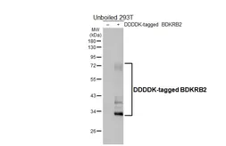 Anti-BDKRB2 antibody [HL5131] used in Western Blot (WB). GTX645327