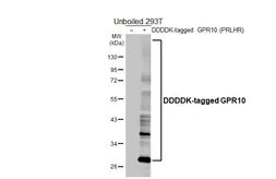 Anti-GPR10 antibody [HL5202] used in Western Blot (WB). GTX645454