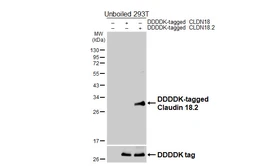 Anti-Claudin 18.2 antibody [HL5230] used in Western Blot (WB). GTX645486