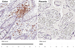 Anti-CD5 antibody [HL5244] used in IHC (Paraffin sections) (IHC-P). GTX645500