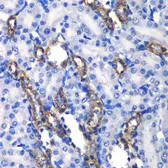 Anti-MATK antibody used in IHC (Paraffin sections) (IHC-P). GTX64561