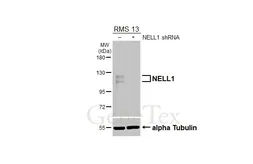 Anti-NELL1 antibody [HL5288] used in Western Blot (WB). GTX645726