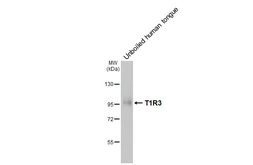 Anti-TAS1R3 antibody [HL5308] used in Western Blot (WB). GTX645773