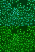 Anti-SKP2 antibody used in Immunocytochemistry/ Immunofluorescence (ICC/IF). GTX64578