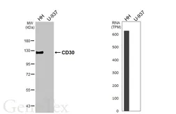 Anti-CD30 antibody [HL5323] used in Western Blot (WB). GTX645788
