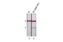 Anti-Enterovirus D68 VP1 antibody [HL5333] used in Lateral Flow (Lateral Flow). GTX645811