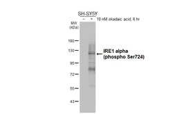 Anti-IRE1 alpha (phospho Ser724) antibody [HL5384] used in Western Blot (WB). GTX645952