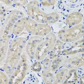 Anti-STK3 antibody used in IHC (Paraffin sections) (IHC-P). GTX64607