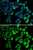 Anti-USP8 antibody used in Immunocytochemistry/ Immunofluorescence (ICC/IF). GTX64608
