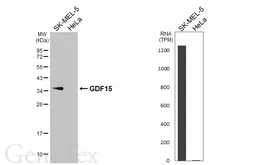 Anti-GDF15 antibody [HL5448] used in Western Blot (WB). GTX646090