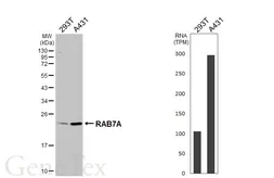 Anti-RAB7A antibody [HL5462] used in Western Blot (WB). GTX646104