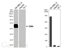 Anti-GBA antibody [HL5482] used in Western Blot (WB). GTX646146