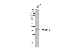 Anti-Cyclin D1 antibody [HL5522] used in Western Blot (WB). GTX646185