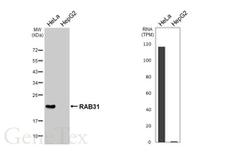 Anti-RAB31 antibody [HL5595] used in Western Blot (WB). GTX646277